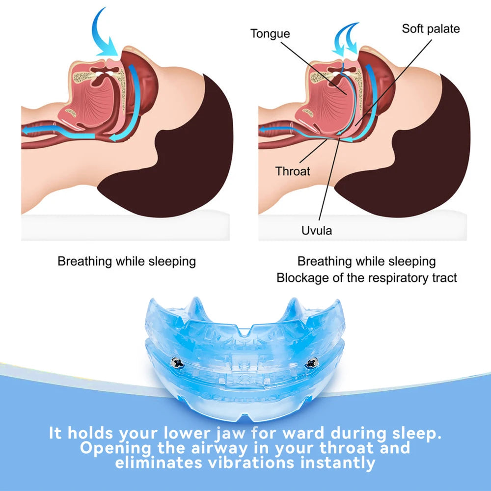 Adjustable Anti-Snoring Mouth Guard