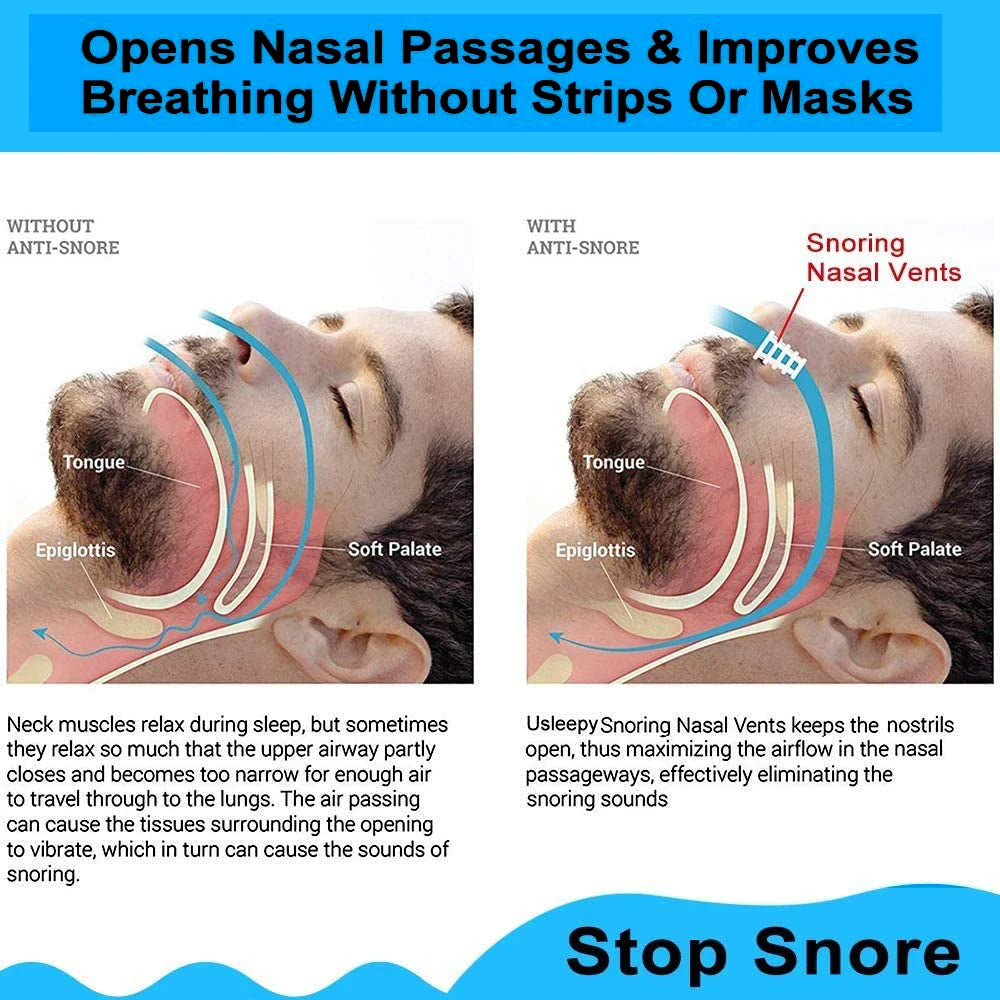 8PCS Anti-Snoring Nose Clips – Silicone Nasal Dilators Sleep Aid